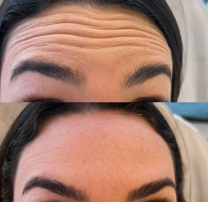 Antes e depois — caso 6